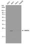 RAB7A, Member RAS Oncogene Family antibody, PA5-78237, Invitrogen Antibodies, Western Blot image 