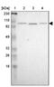 KH And NYN Domain Containing antibody, PA5-51923, Invitrogen Antibodies, Western Blot image 