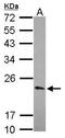 Potassium Voltage-Gated Channel Interacting Protein 1 antibody, GTX116103, GeneTex, Western Blot image 