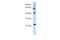 Tetraspanin 3 antibody, A13184, Boster Biological Technology, Western Blot image 