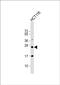 RAB8A, Member RAS Oncogene Family antibody, PA5-72605, Invitrogen Antibodies, Western Blot image 