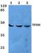 General Transcription Factor IIH Subunit 2 antibody, PA5-36267, Invitrogen Antibodies, Western Blot image 