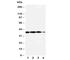 Arginase 2 antibody, R30903, NSJ Bioreagents, Western Blot image 