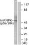 Heterogeneous Nuclear Ribonucleoprotein K antibody, P01793, Boster Biological Technology, Western Blot image 
