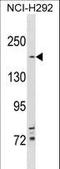 TSC Complex Subunit 2 antibody, LS-C156996, Lifespan Biosciences, Western Blot image 