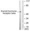 Thyroid Hormone Receptor Beta antibody, LS-C118594, Lifespan Biosciences, Western Blot image 