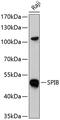 Spi-B Transcription Factor antibody, GTX32893, GeneTex, Western Blot image 