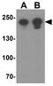 Myosin Heavy Chain 8 antibody, GTX32145, GeneTex, Western Blot image 