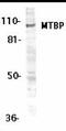MDM2 Binding Protein antibody, MBS395538, MyBioSource, Western Blot image 