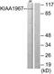 Cell Cycle And Apoptosis Regulator 2 antibody, TA315685, Origene, Western Blot image 