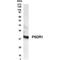 Retinol Dehydrogenase 11 antibody, GTX70423, GeneTex, Western Blot image 