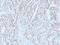 MutL Homolog 1 antibody, LS-C744536, Lifespan Biosciences, Immunohistochemistry paraffin image 