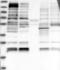 Tubulin Tyrosine Ligase Like 5 antibody, NBP1-93609, Novus Biologicals, Western Blot image 