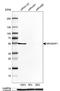 Rho GTPase Activating Protein 1 antibody, NBP1-85724, Novus Biologicals, Western Blot image 