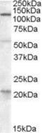 Diacylglycerol Lipase Alpha antibody, GTX88615, GeneTex, Western Blot image 