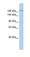 Tight Junction Protein 1 antibody, orb329880, Biorbyt, Western Blot image 