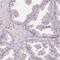 TIMELESS-interacting protein antibody, PA5-58892, Invitrogen Antibodies, Immunohistochemistry paraffin image 