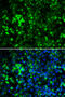 RAK antibody, STJ28217, St John