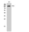 Protein Tyrosine Kinase 2 Beta antibody, STJ95280, St John