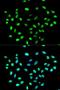 Heterogeneous Nuclear Ribonucleoprotein K antibody, LS-C331644, Lifespan Biosciences, Immunofluorescence image 