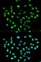 Heterogeneous Nuclear Ribonucleoprotein K antibody, LS-C331644, Lifespan Biosciences, Immunofluorescence image 
