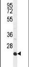 Intercellular Adhesion Molecule 2 antibody, PA5-24524, Invitrogen Antibodies, Western Blot image 