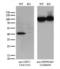 GIPC PDZ Domain Containing Family Member 1 antibody, LS-C796175, Lifespan Biosciences, Western Blot image 