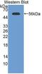 Laminin Subunit Gamma 2 antibody, abx130694, Abbexa, Western Blot image 