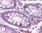 Polo Like Kinase 1 antibody, NBP1-02851, Novus Biologicals, Immunohistochemistry paraffin image 