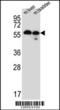 Transmembrane Protein 87B antibody, 61-870, ProSci, Western Blot image 