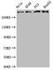 ATM Serine/Threonine Kinase antibody, CSB-RA618770A0HU, Cusabio, Western Blot image 