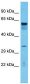 TOX High Mobility Group Box Family Member 4 antibody, TA343756, Origene, Western Blot image 