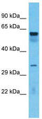 TOX high mobility group box family member 4 antibody, TA343756, Origene, Western Blot image 