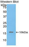 Inhibin Subunit Alpha antibody, LS-C294604, Lifespan Biosciences, Western Blot image 