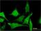 Tubulin-specific chaperone C antibody, H00006903-M04, Novus Biologicals, Immunocytochemistry image 