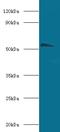 Cholinergic Receptor Nicotinic Alpha 1 Subunit antibody, LS-C318257, Lifespan Biosciences, Western Blot image 