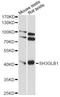 SH3 Domain Containing GRB2 Like, Endophilin B1 antibody, LS-C749871, Lifespan Biosciences, Western Blot image 