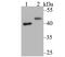 Suppressor Of Variegation 3-9 Homolog 2 antibody, A05361, Boster Biological Technology, Western Blot image 