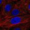 Enhancer Of MRNA Decapping 3 antibody, NBP2-57115, Novus Biologicals, Immunofluorescence image 