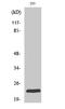 Ras-related protein Rab-35 antibody, A03845, Boster Biological Technology, Western Blot image 