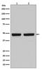 Hyaluronan And Proteoglycan Link Protein 1 antibody, M05980-1, Boster Biological Technology, Western Blot image 