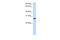 Synaptonemal complex protein 3 antibody, 27-155, ProSci, Enzyme Linked Immunosorbent Assay image 