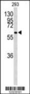Cell Division Cycle 73 antibody, MBS9206657, MyBioSource, Western Blot image 