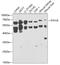 Parathyroid Hormone 1 Receptor antibody, GTX55766, GeneTex, Western Blot image 