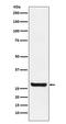 Sprouty RTK Signaling Antagonist 4 antibody, M04343, Boster Biological Technology, Western Blot image 