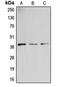 Beta-1,3-Galactosyltransferase 4 antibody, orb214816, Biorbyt, Western Blot image 