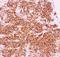 Nuclear Factor Kappa B Subunit 1 antibody, LS-C344015, Lifespan Biosciences, Immunohistochemistry frozen image 