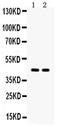 Aquaporin 4 antibody, PA5-78812, Invitrogen Antibodies, Western Blot image 