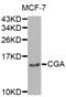  antibody, abx001151, Abbexa, Western Blot image 