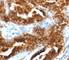 TAG-72 antibody, V2363IHC-7ML, NSJ Bioreagents, Immunohistochemistry paraffin image 